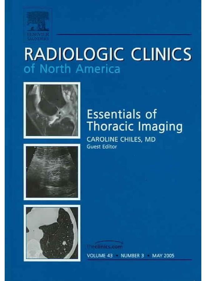 Essentials of Thoracic Imaging  Ed   1