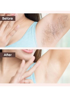 ماركة غير محددة مزيل الشعر ، ماكينة حلاقة كهربائية للمرأة ، الناقل التسلسلي العام أداة إزالة الشعر الصغيرة القابلة لإعادة الشحن ، الذراع ، الساق ، الإبط ، بيكيني المناطق والوجه ( الوردي )  - Image 3