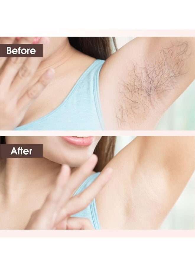 ماركة غير محددة مزيل الشعر ، ماكينة حلاقة كهربائية للمرأة ، الناقل التسلسلي العام أداة إزالة الشعر الصغيرة القابلة لإعادة الشحن ، الذراع ، الساق ، الإبط ، بيكيني المناطق والوجه ( الوردي )  - Image 3