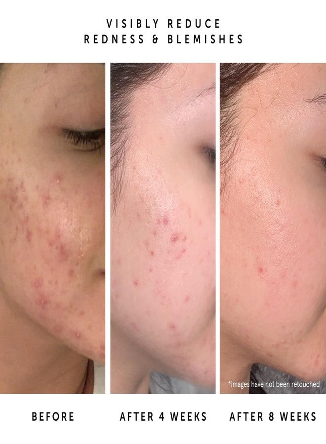 HERBIVORE Lapis Balancing Facial Oil with Blue Tansy + Squalane, Safe for Acne-Prone Skin | Helps Soothe Redness + Balance Oil Production, Lightweight, Non-Comedogenic, Plant-Based, 30 mL / 1 oz - Image 5