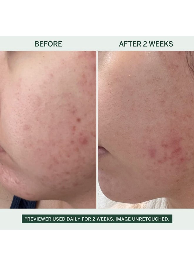 FACETORY Urban Calm Hydrating Vita Serum Glow Boosting Facial Serum With Fermented Mung Bean & 10% Niacinamide For Fine Lines & Wrinkles Plump & Revive Dry Skin Smoothing & Calming 30Ml / 1.01 Fl Oz  - Image 2