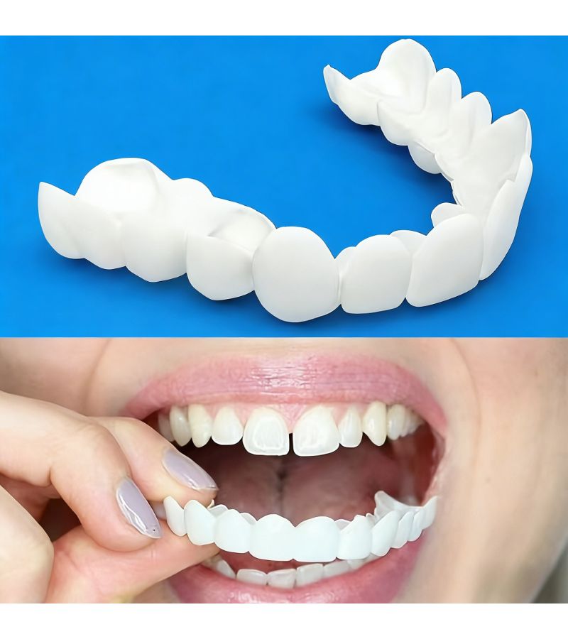 4 Pack White Disposable Simulation Tooth Socket Comfortable And Flexible Teeth Veneer Suitable For Upper And Lower Teeth Men And Women 2 Upper Teeth 2 Lower Teeth - Image 1