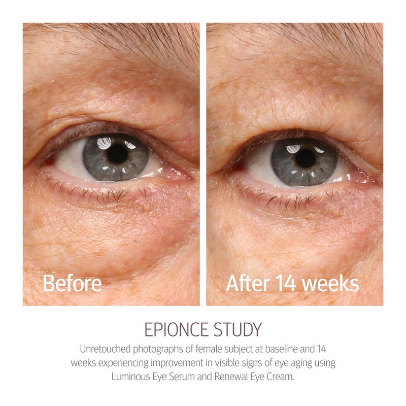 Epionce Renewal Eye Cream - Anti-Aging, Under Eye Cream for Dark Circles, Fine Lines, Wrinkles & Puffiness with Hyaluronic Acid, For All Skin Types, Dermatologist Skincare - Image 3
