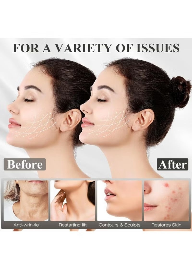 Chin Strap for Sleeping,Adjustable Chin Strap,Jaw Strap,Jawline Shaper,V Line Lifting Mask,Black - Image 3