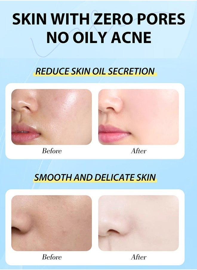 MOOYAM - Salicylic Acid Serum - Facial Serum with Salicylic Acid 2% for Acne and Acne Treatment 30ml, Unisex - Image 1