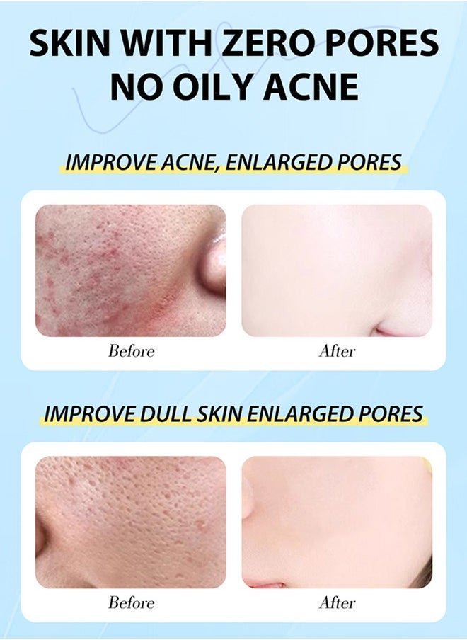 MOOYAM - Salicylic Acid Serum - Facial Serum with Salicylic Acid 2% for Acne and Acne Treatment 30ml, Unisex - Image 1