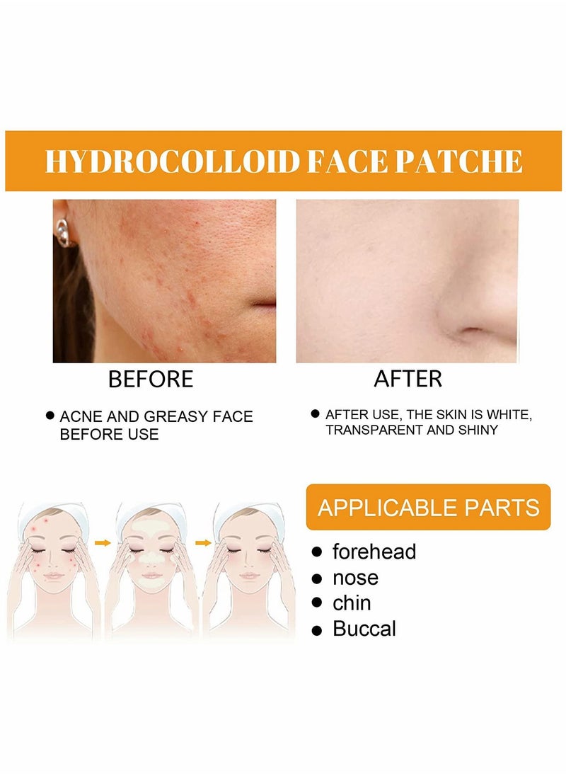SYOSI - Hydrocolloid Face Mask for Acne, 5 Large Pimple Patches for Zit Breakouts on Nose, Chin, Forehead & Cheeks, Pore Cleansing Strips Acne Patches for All Skin Types (2 Box(40 Pcs)) - Image 1