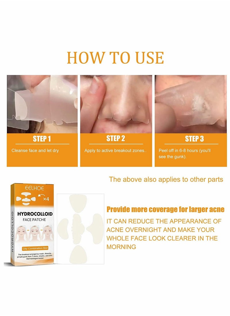 SYOSI - Hydrocolloid Face Mask for Acne, 5 Large Pimple Patches for Zit Breakouts on Nose, Chin, Forehead & Cheeks, Pore Cleansing Strips Acne Patches for All Skin Types (2 Box(40 Pcs)) - Image 1