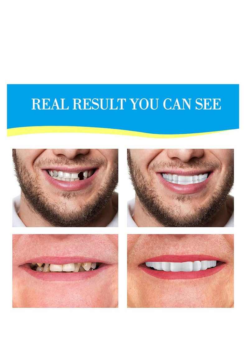 حياة مجنونة طقم إصلاح الأسنان، أطقم أسنان قابلة للتعديل، قوالب أطقم أسنان مؤقتة قابلة للتخصيص لاستعادة ابتسامة واثقة - Image 5