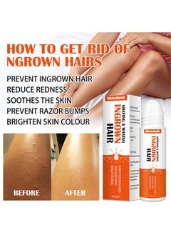 West&Month Ingrown Hair- Get Rid of Beard Nursing Essential Oils,Repairing Serum to Reduce Dark Spots After Shaving Gentle on Ingrown Hair 20ml  - Image 3