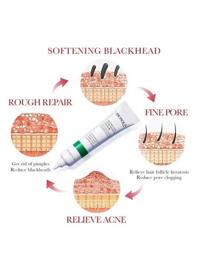 BIOAOUA Salicylic Acid Acne Removal Cream , Acne Treatment Face Cream, Acne Spot Treatment for Face & Acne Dots, Natural Cystic Acne Treatment, For All Skin Types, Premium Acne Scar Cream & Pimple Remover 20g - Image 4