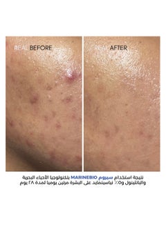 نات_بوتانيكالز مجموعة 9% نياسيناميد من نوت بوتانيكالز مع تكنولوجيا الاحياء البحرية و نوعين من الهيالورونيك اسيد و البانثينول  - Image 2