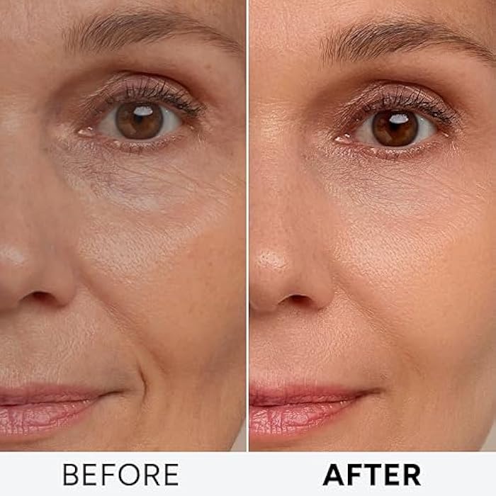 Arvesa Retinol Cream for Face with Collagen and Hyaluronic Acid - Anti Aging Wrinkle Cream for Women and Men - Day and Night Facial Moisturizer for Tightening and Skin Firming - Crema Hidratante Para la Cara - Image 4