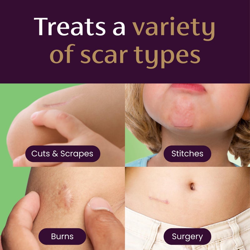 ميديرما Scar Gel for Kids, Reduces the Appearance of Scars, 1 Pediatrician Recommended, Goes on Purple, Rubs in Clear, Kid Friendly, Grape Scent, 0.70 Oz - Image 4