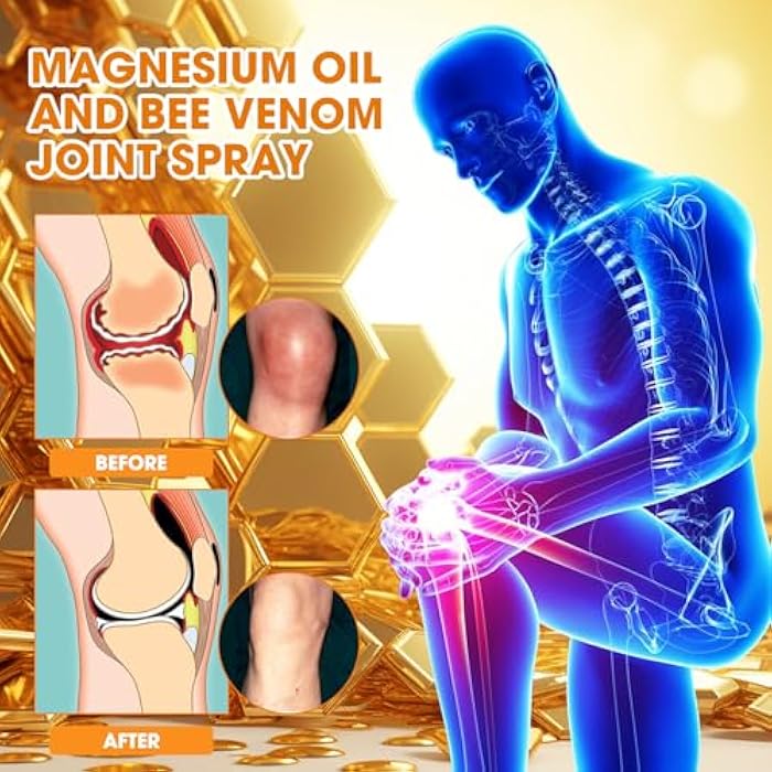 ploreatu Magnesium Joint Spray, Professional Magnesium Joint Oil,Magnesium Oil & Bee Venom Joint Spray for Back, Knee, Hands, Neck （1 PCS,100ml） - Image 5
