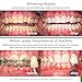 Opalescence Go 10 Whitening Bundle Prefilled Gel Whitening Trays  10 Treatments Hydrogen Peroxide 10  Includes Opalescence Whitening Toothpaste Teeth Whitening Kit Mint 51945166 - Image 4