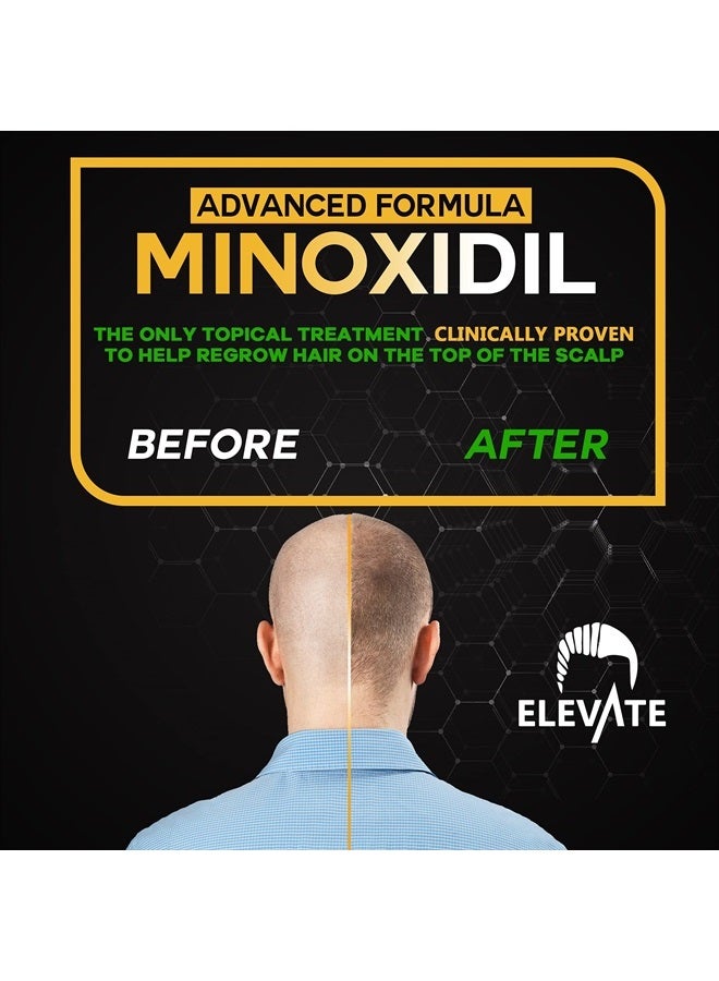 ELEVATE 5% Minoxidil Hair Growth Spray - Alcohol Free Non Oily Formula Extra Strength Professional Treatment for Hair Loss and Hair Regrowth - Stimulate Hair Follicles for Men & Women - 1 Month Supply - Image 3