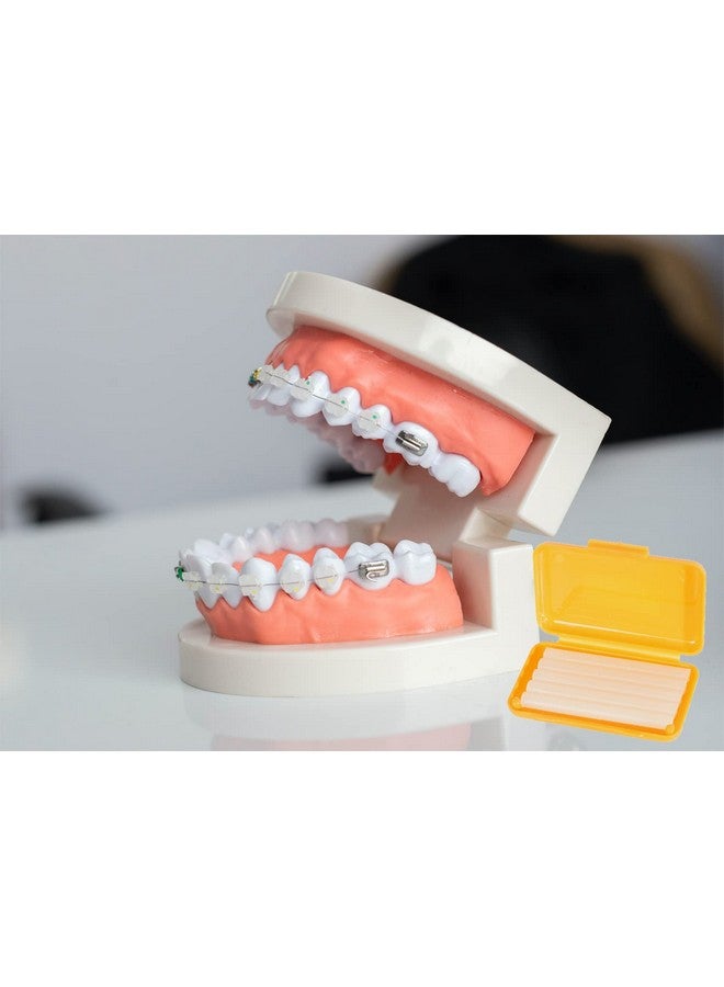 OBTANIM 15 Pack Colorful Braces Wax Dental Care Orthodontic Wax For Braces Wearer (10 Color) - Image 3