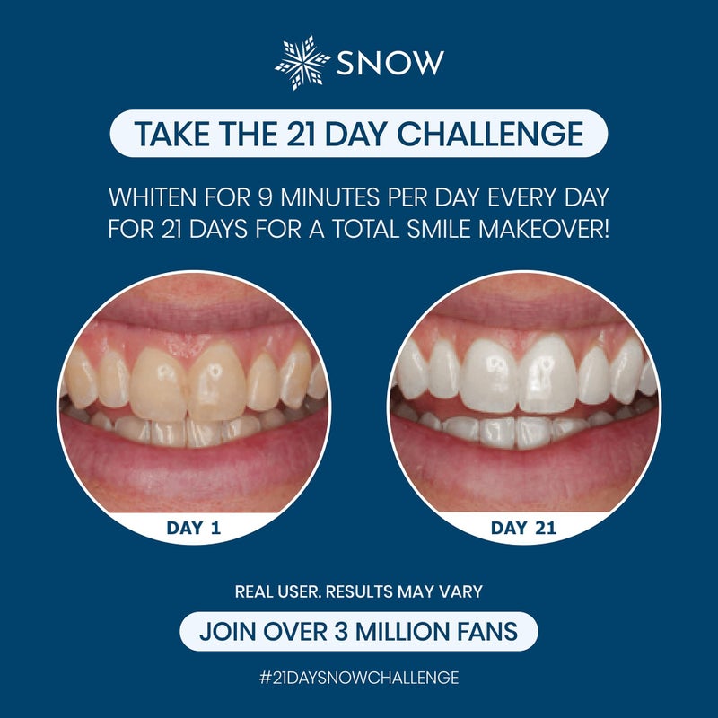 Snow Teeth Whitening Kit - Snow Teeth Whitening Serum and LED Mouthpiece Whitener, Formulated with Hydroxyapatite, Good for 6 Months - Wired Kit with 3 Wands - Image 4