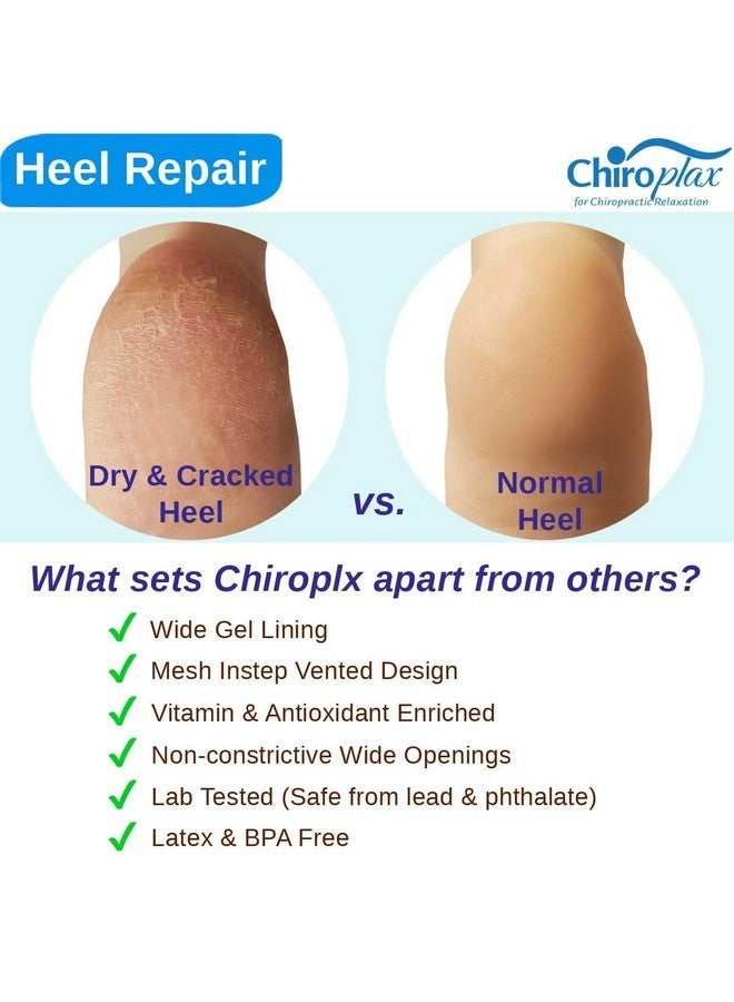 Chiroplax Vented Moisturizing Socks For Dry Cracked Heels Feet Treatment Gel Lined Spa To Repair Heal Soften Calluses Overnight, 2 Pairs (Gray) - Image 5