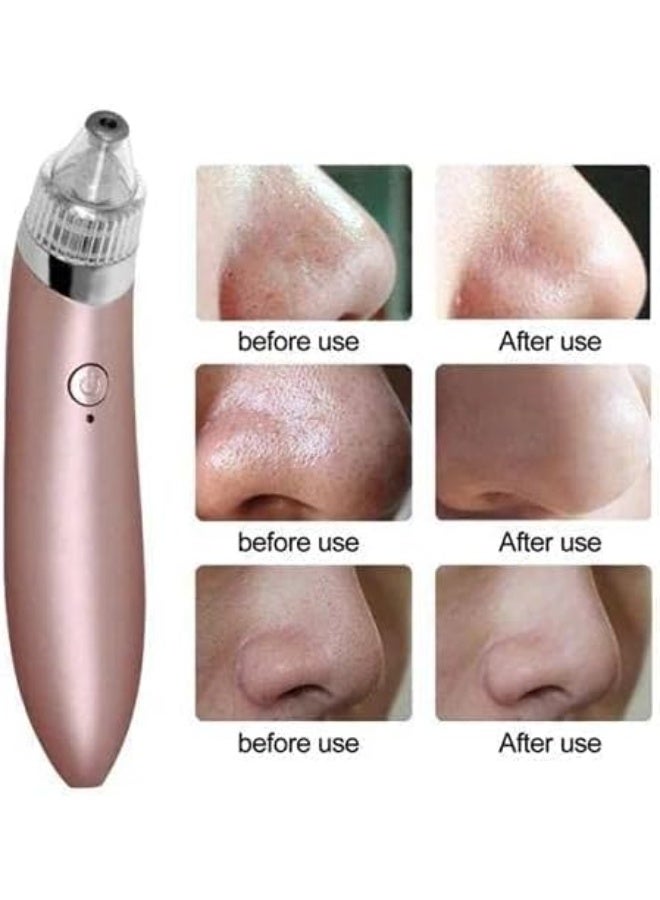Generic Blackhead Remover Vacuum Pore Cleaner with Multiple Heads – Facial Deep Cleansing Device – Nose & Face Pore Cleaning Tool – Rechargeable – Multicolor - Image 2