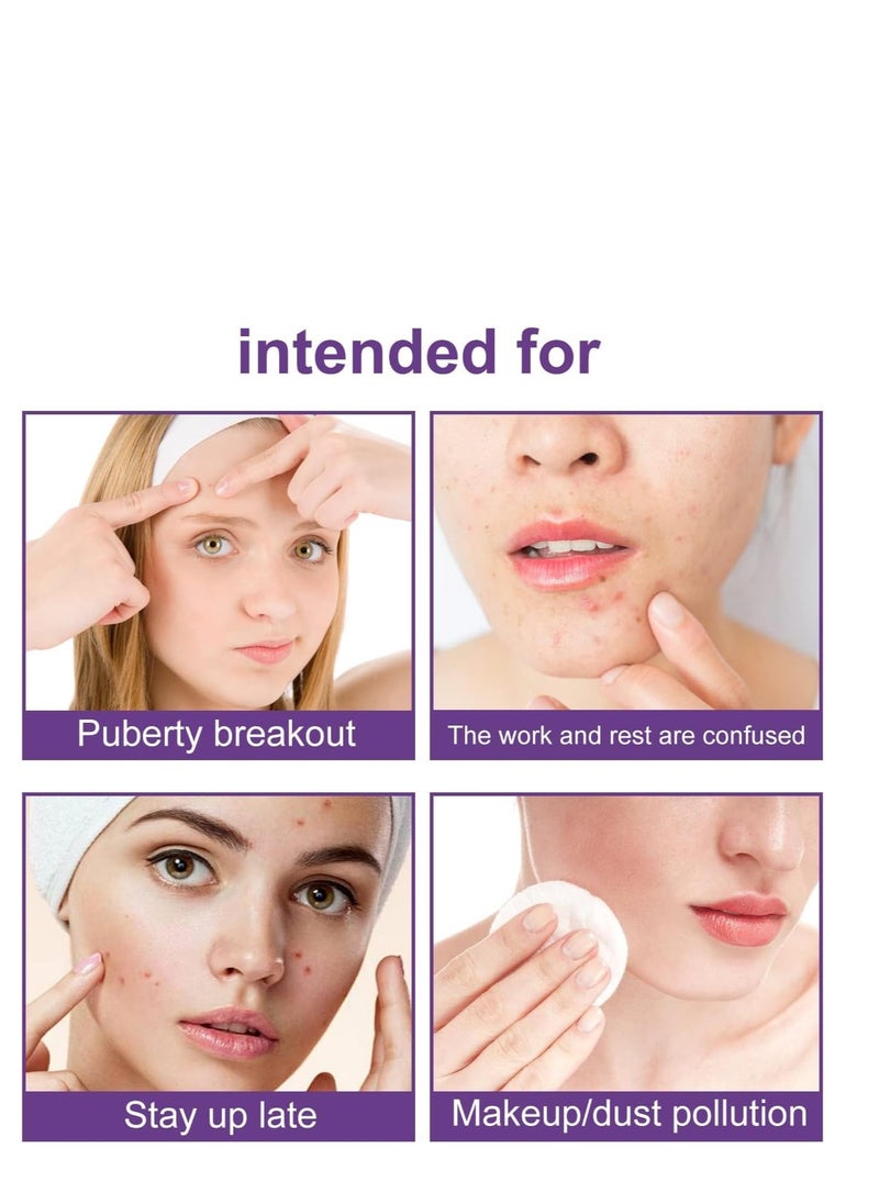 Jaysuing - Star Pimple Patches, 180 Patches, Pimple Patches For Face, Hydrocolloid Acne Patches, Pimple Patches Stars, Zit Patches For Zits, Blemishes, Breakouts, Waterproof And breathable For Acne-prone Skin - Image 1