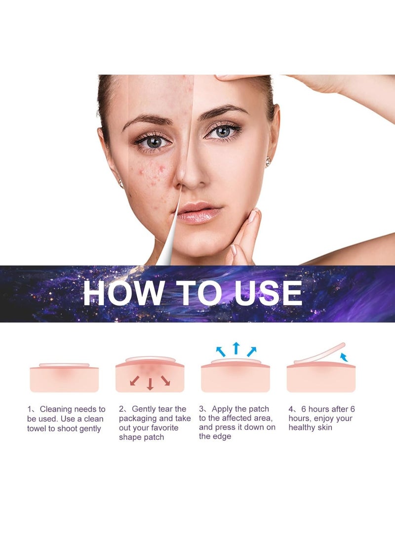 Jaysuing - Star Pimple Patches, 180 Patches, Pimple Patches For Face, Hydrocolloid Acne Patches, Pimple Patches Stars, Zit Patches For Zits, Blemishes, Breakouts, Waterproof And breathable For Acne-prone Skin - Image 1