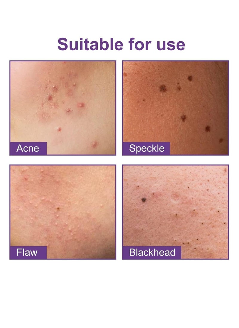 Jaysuing - Star Pimple Patches, 180 Patches, Pimple Patches For Face, Hydrocolloid Acne Patches, Pimple Patches Stars, Zit Patches For Zits, Blemishes, Breakouts, Waterproof And breathable For Acne-prone Skin - Image 1