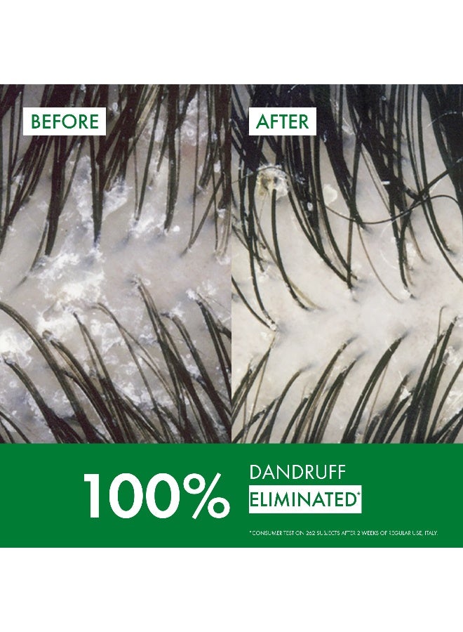 VICHY Dercos Anti Dandruff Shampoo For Dry Hair 200ml - Image 3