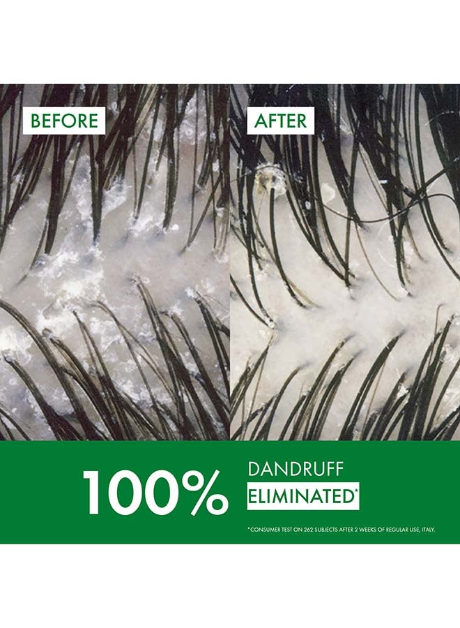 VICHY Dercos Anti Dandruff Shampoo For Dry Hair 200ml - Image 3