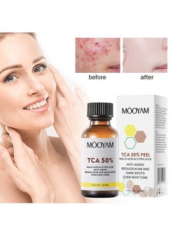 MOOYAM TCA 50% Peel Malic Acid & Citric Acid，Citric Acid Peeling Serum, Professional Chemical Peel for Face, TCA 50% Peeling Solution, Chemical Exfolianting Facial Peel for Dark Skin, Dark Spots, Acne, Wrinkle  - Image 1