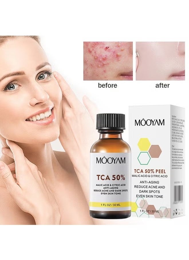 MOOYAM - TCA 50% Peel Malic Acid & Citric Acid，Citric Acid Peeling Serum, Professional Chemical Peel for Face, TCA 50% Peeling Solution, Chemical Exfolianting Facial Peel for Dark Skin, Dark Spots, Acne, Wrinkle - Image 1