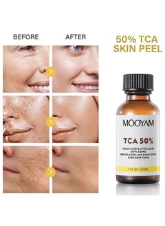 MOOYAM TCA 50% Peel Malic Acid & Citric Acid，Citric Acid Peeling Serum, Professional Chemical Peel for Face, TCA 50% Peeling Solution, Chemical Exfolianting Facial Peel for Dark Skin, Dark Spots, Acne, Wrinkle  - Image 3