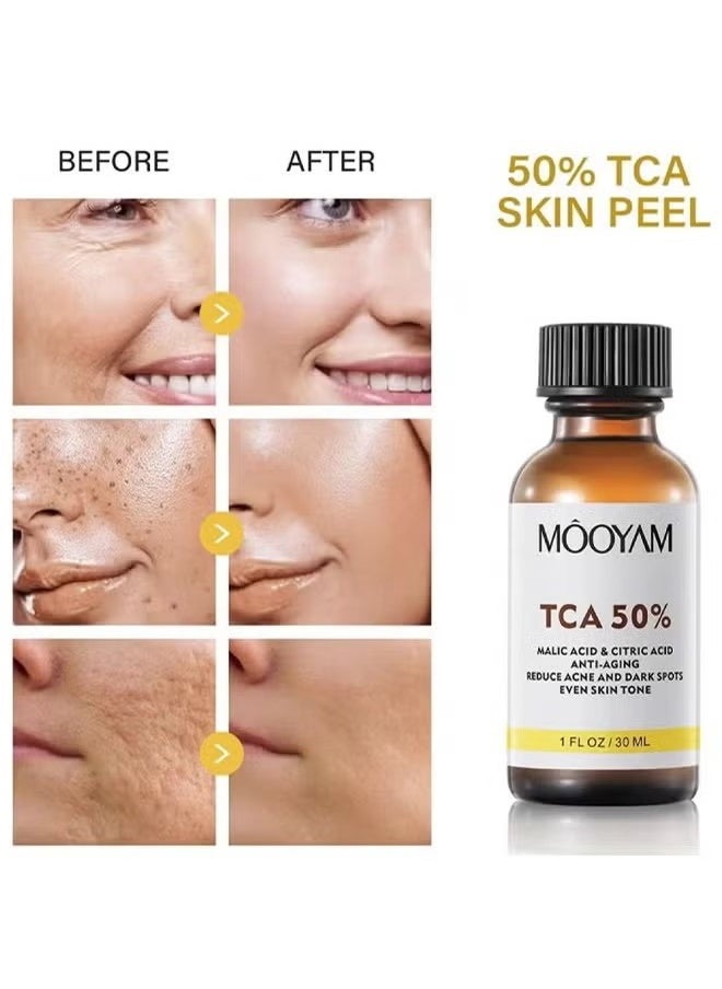 MOOYAM - TCA 50% Peel Malic Acid & Citric Acid，Citric Acid Peeling Serum, Professional Chemical Peel for Face, TCA 50% Peeling Solution, Chemical Exfolianting Facial Peel for Dark Skin, Dark Spots, Acne, Wrinkle - Image 1