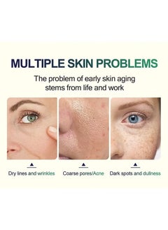 MOOYAM TCA 50% Peel Malic Acid & Citric Acid，Citric Acid Peeling Serum, Professional Chemical Peel for Face, TCA 50% Peeling Solution, Chemical Exfolianting Facial Peel for Dark Skin, Dark Spots, Acne, Wrinkle  - Image 4