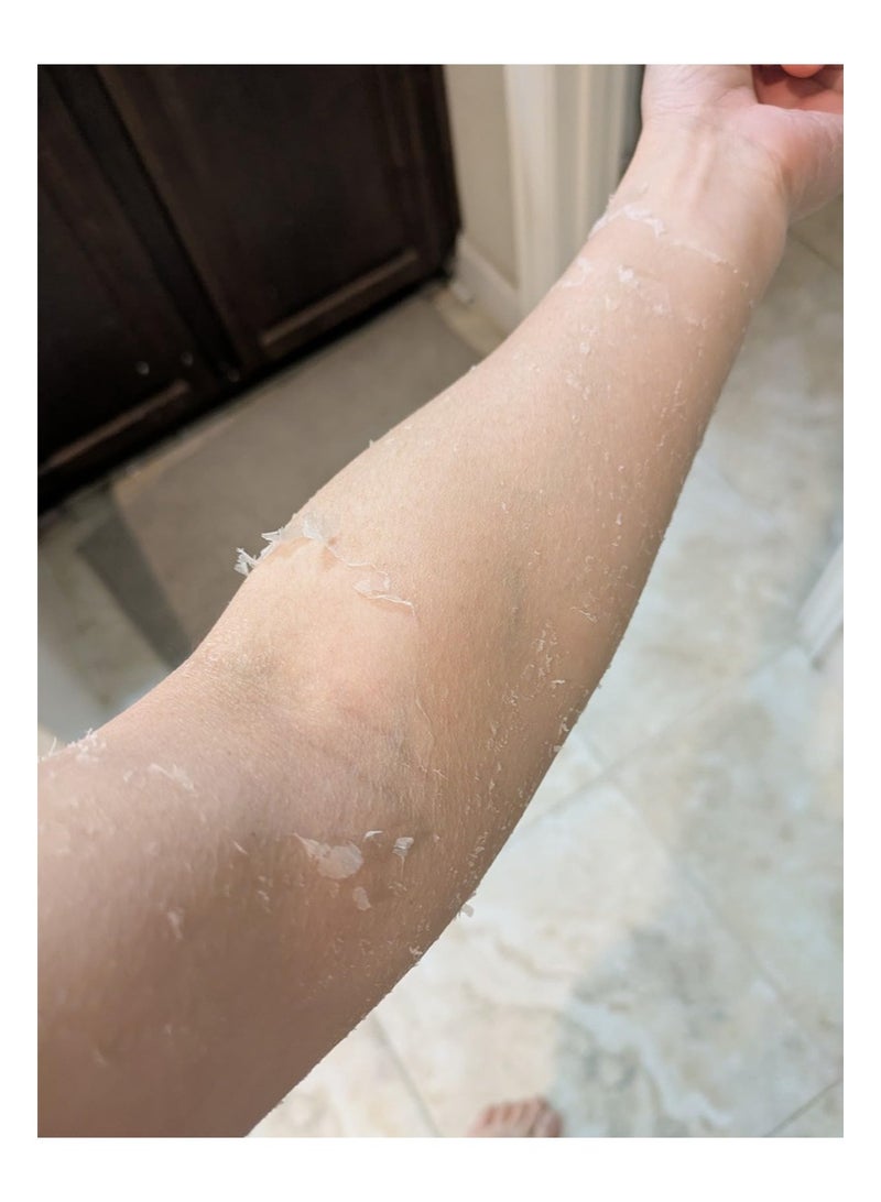 MOOYAM Extra Strong Yellow Peeling Oil for Dark Skin,Yellow Exfoliating Oil,Facial Peeling,Fruit Acid Exfoliator,Body Lightening and Whitening Creams Peeling Oil,Skin Lightening,Hand Oil Scrub,Exfoliant Peels Solution at Home Body Peeling for Exfoliate Body Hand Foot Knuckle All Skin Type Dead Skin Remover (3.66 Fl OZ/110ML) - Image 3