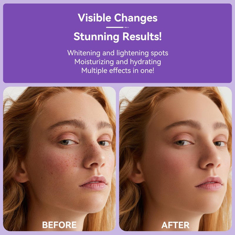DMYGO Dark Spot Remover for Face Body and Hands, Dark Spot Corrector for Melasma Age Spot Sun Spot, Brown Spot Remover for Women and Men with 360Â° Roller - 0.67 floz - Image 4