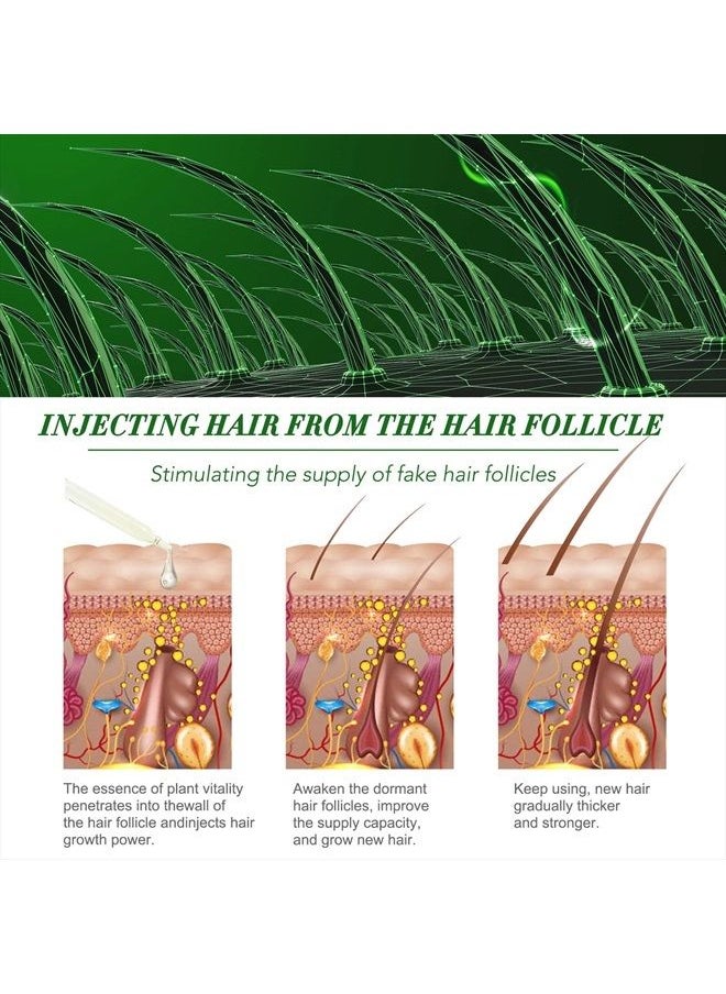 ALIVER - Rosemary Oil for Hair Growth (4 Fl Oz), Organic Rosemary Essential Oils, Rosemary Oil for Hair Loss Treatment, Stimulates Hair Growth, Scalp Massager, Aromatherapy - Image 1