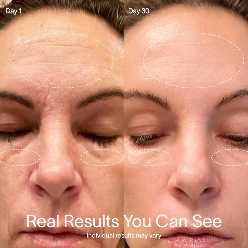 Solawave 4-in-1 Red Light Therapy Wand for Face & Neck | Beauty Device with Galvanic Current, Massager & Warmth | Anti-Aging, Wrinkle Reduction, Skin Tightening, Depuffing & Rejuvenation (Rose Gold) - Image 4