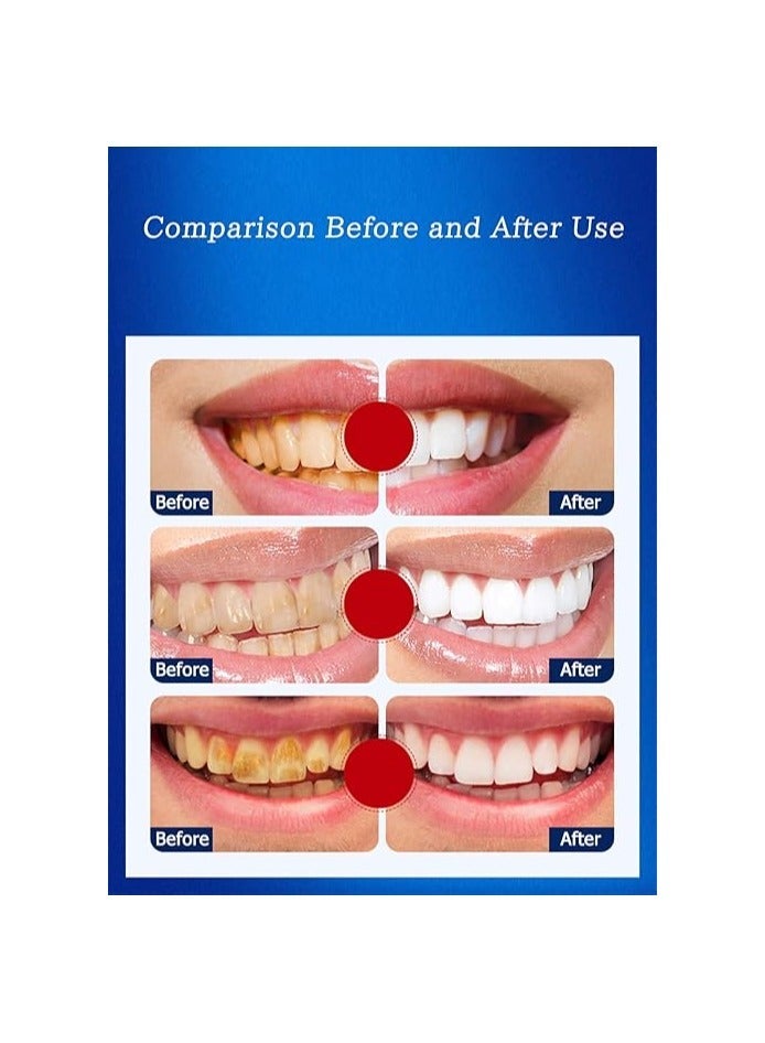 5 Pieces 5D Teeth Whitening Strips - Image 3