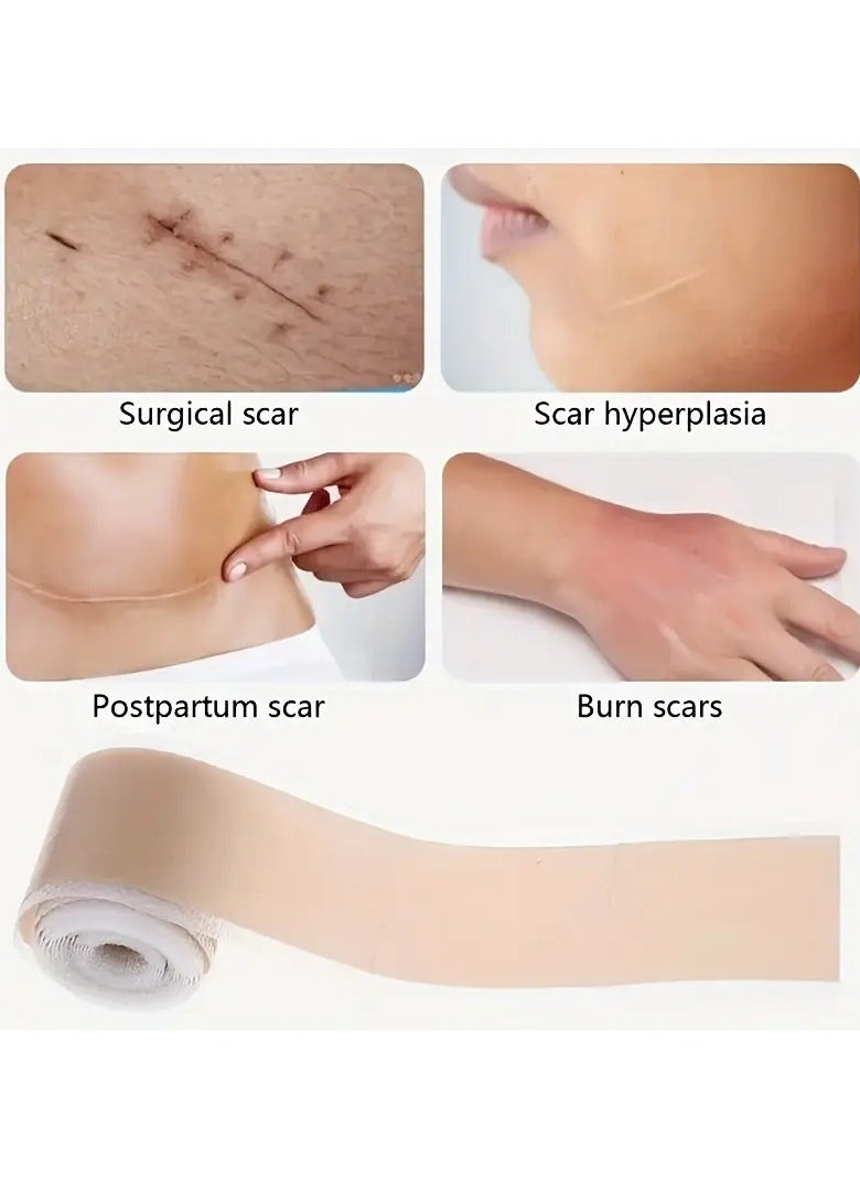 Rozino 1 Roll Scar Invisible tattoo Sticker 4cm*1.5m Silicone Gel Roll Silicone Tape Cover And Fade Scar Light Beige Tone Invisible Sticker Scar Coverage Tattoo Sticker  - Image 5