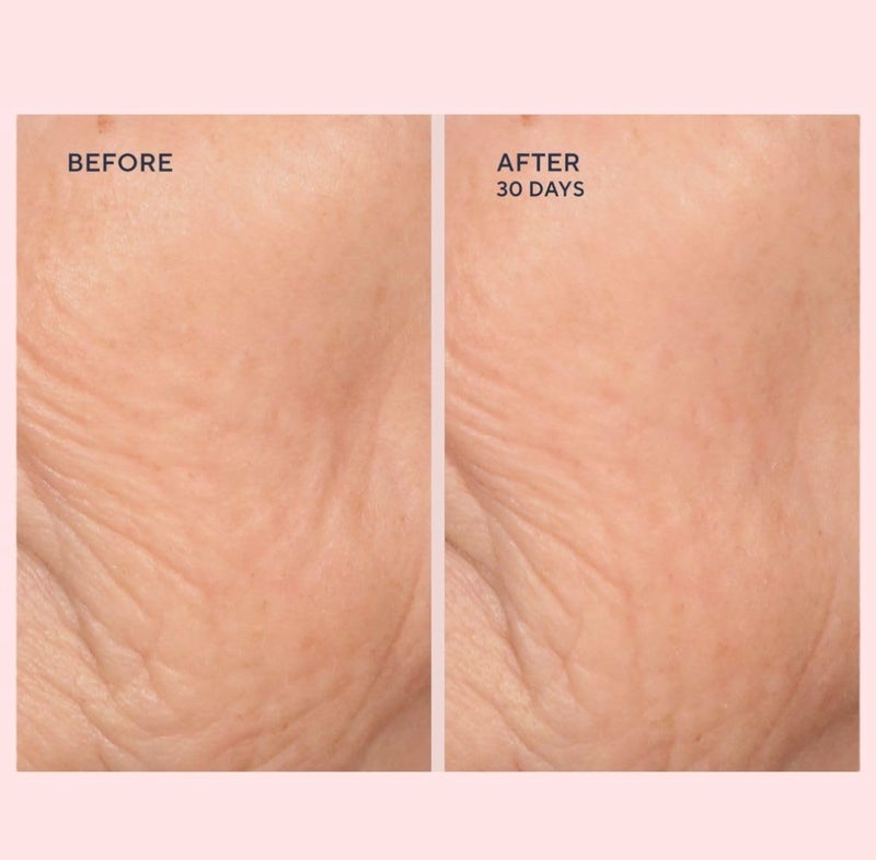 Serious Skincare - C-Extreme Results Facial Exfoliator - Deep Pore Cleansing & Resurfacing Skin Treatment - Vitamin C, Collagen & Natural Fruit Enzymes - For Smoother Radiant Face & Neck - 2 fl. oz - Image 3