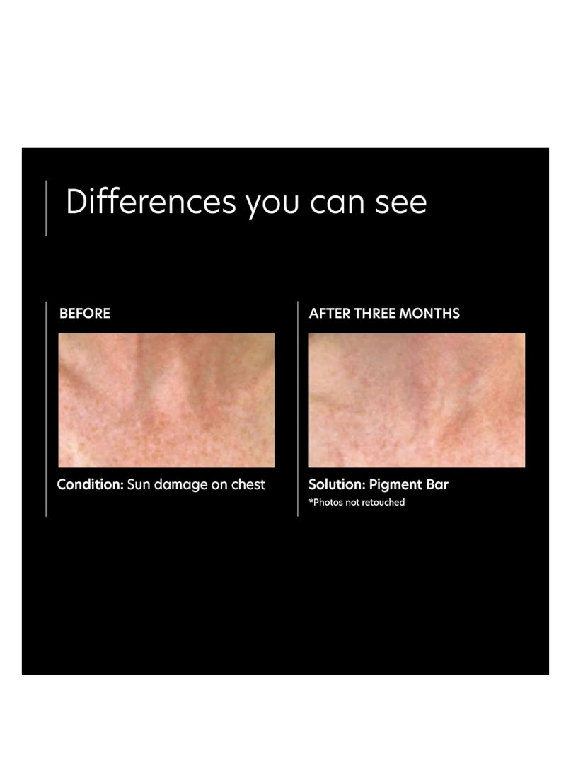 PCA SKIN PCA SKIN Pigment Bar, Hyperpigmentation Soap for Dark Spots, Formulated with Azelaic Acid and Kojic Acid, 3.2 fl oz Jar  - Image 3