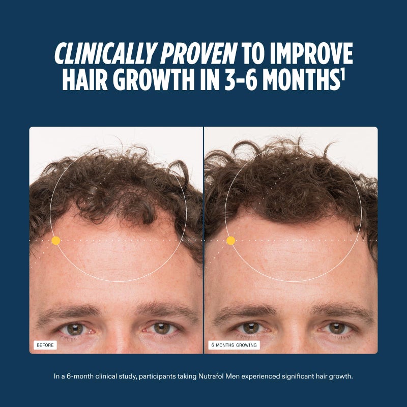 Nutrafol Men's Hair Growth Supplements, Clinically Tested for Visibly Thicker Hair and Scalp Coverage, Dermatologist Recommended - 1 Month Supply - Image 4