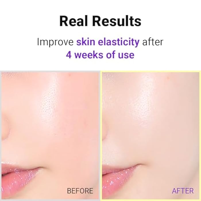 ISNTREE Hyper Retinol EX 1.0 Serum 20ml | 5 Peptides | 5 Cermaides | Helps Reduce Fine Lines - Image 5