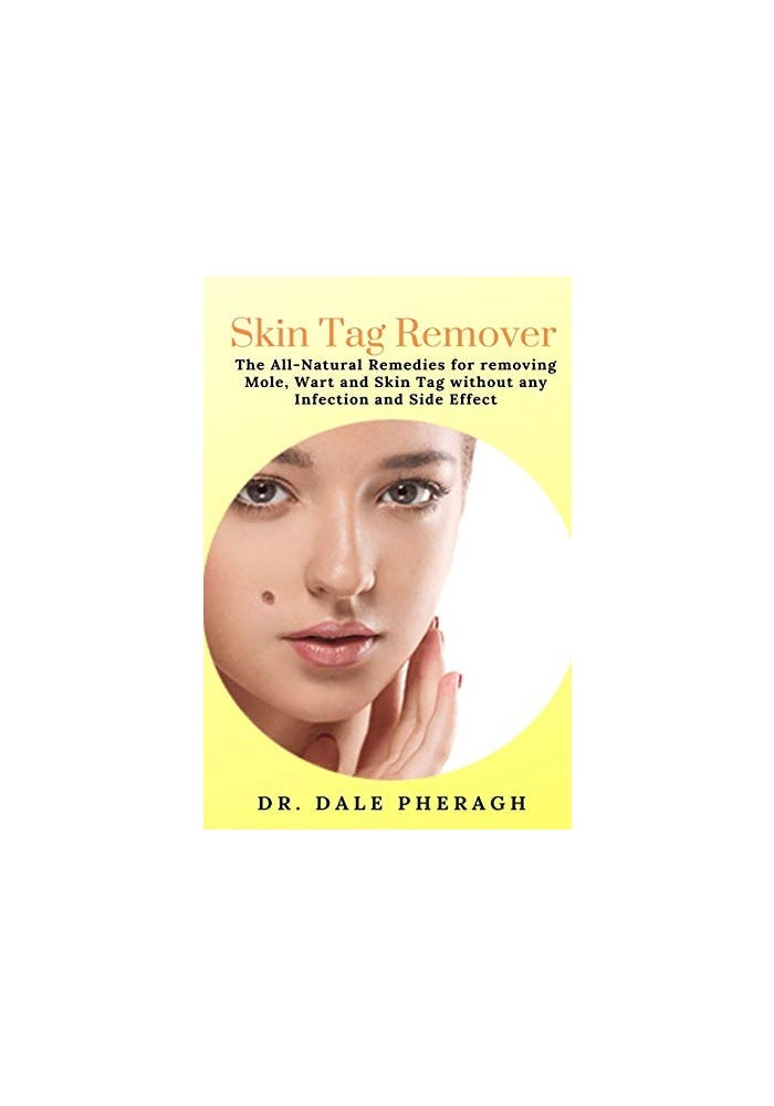 Skin Tag Remover: The All-Natural Remedies for removing Mole, Wart and Skin Tag without any Infection and Side Effect