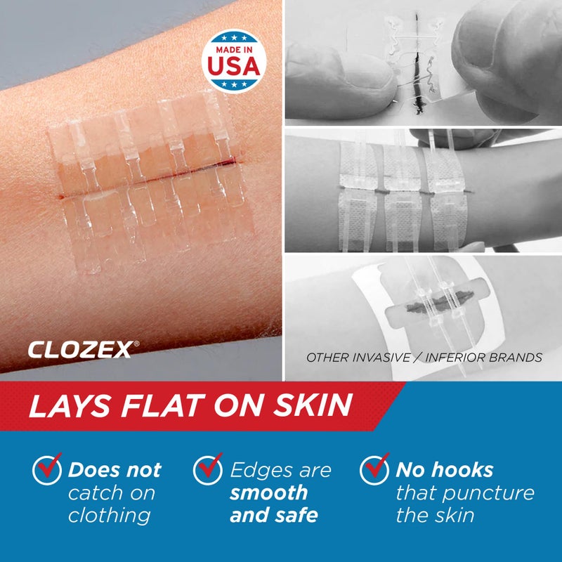Clozex Emergency Laceration Closures - Repair Wounds Without Stitches, Skin Closure Device for 3 Individual Wounds Or Combine for Total Length of 4 1/4 Inches - Image 4