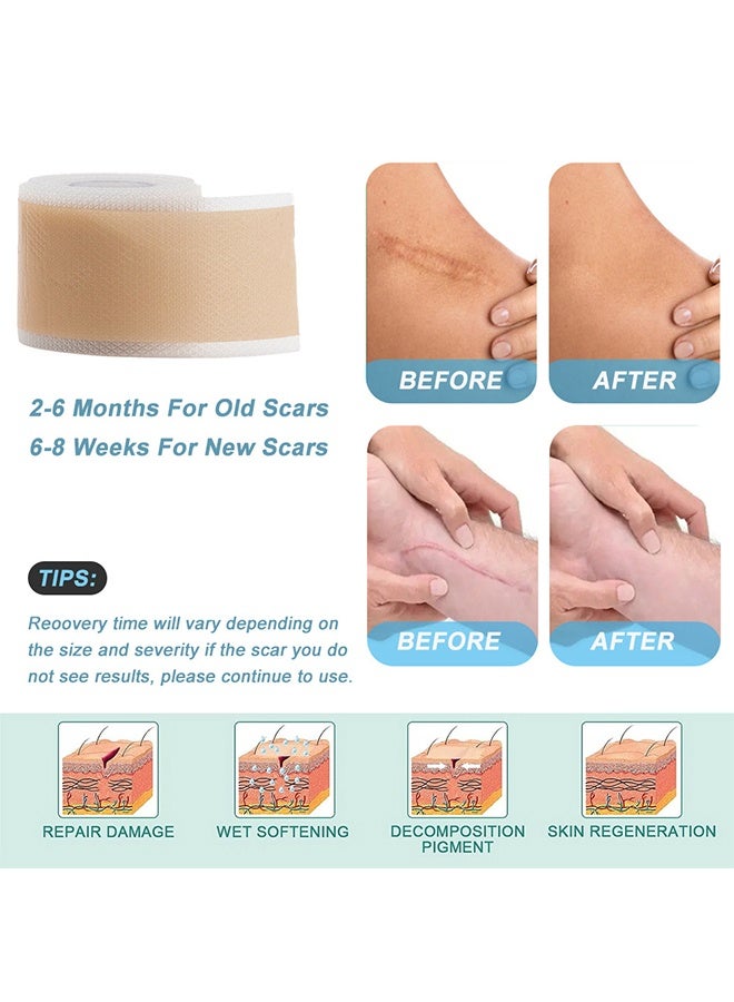 Flushy Silicone Scar Tape - Scar Roll Sticker Self-Adhesive Scar Removal Sticker 4CM*1.5M - Image 3