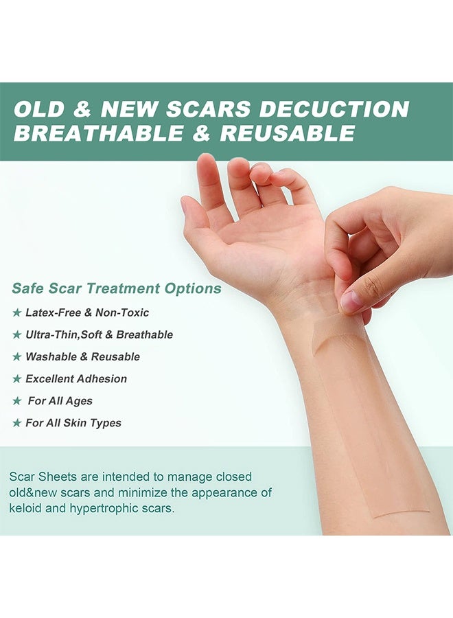 Flushy Silicone Scar Tape - Scar Roll Sticker Self-Adhesive Scar Removal Sticker 4CM*1.5M - Image 5