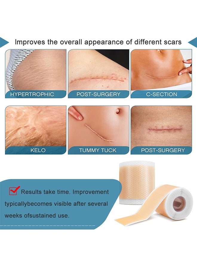 Flushy Silicone Scar Tape - Scar Roll Sticker Self-Adhesive Scar Removal Sticker 4CM*1.5M - Image 2